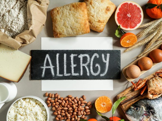 Allergieën en dieetwensen